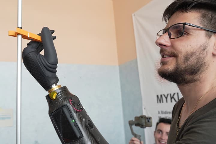 Test subject Daniel uses the "myokinetic hand" to grasp and remove a clothes peg