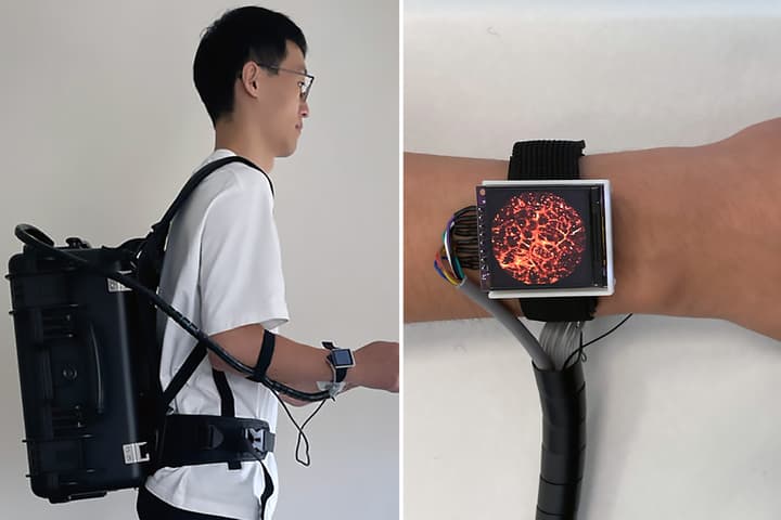 High-res photoacoustic imaging tech has been shrunk to fit in a watch