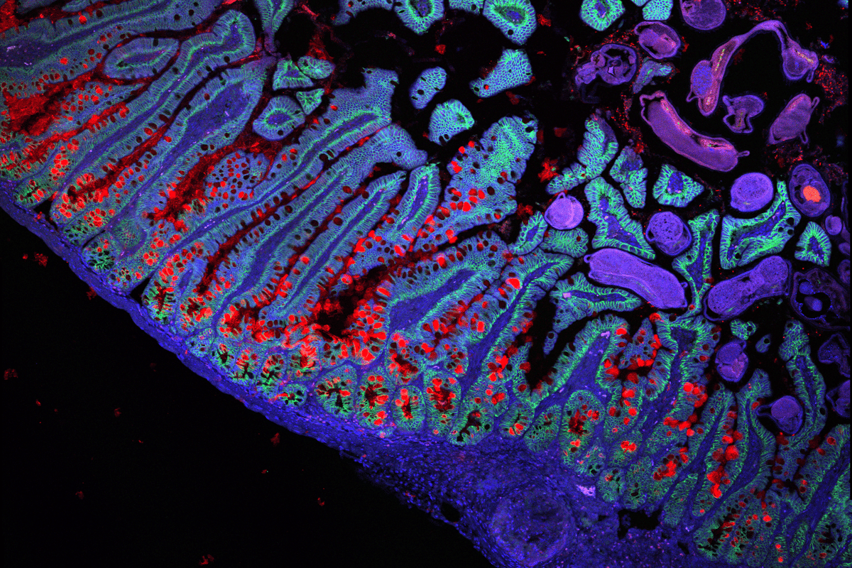 The human small intestine