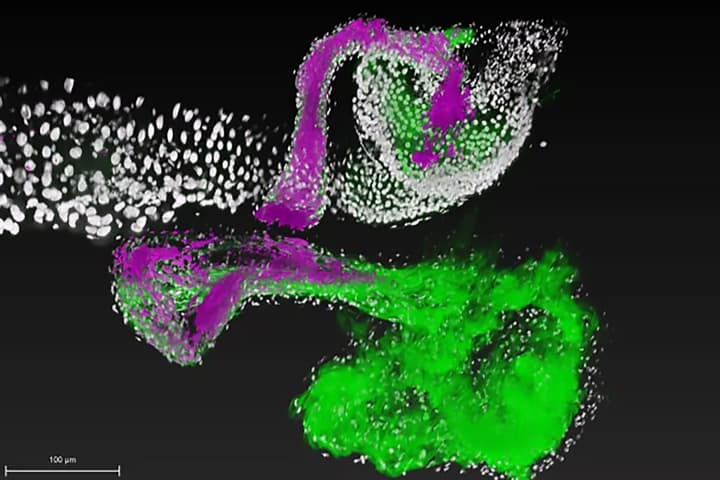 A beneficial bacteria (magenta) attaches to specific regions of the gut (green)